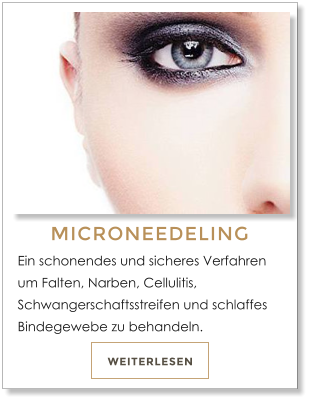 WEITERLESEN MICRONEEDELING Ein schonendes und sicheres Verfahren um Falten, Narben, Cellulitis, Schwangerschaftsstreifen und schlaffes Bindegewebe zu behandeln.